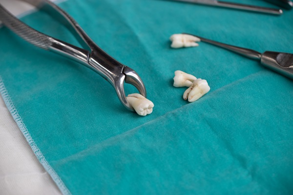 A Step By Step Guide To A Tooth Extraction Procedure